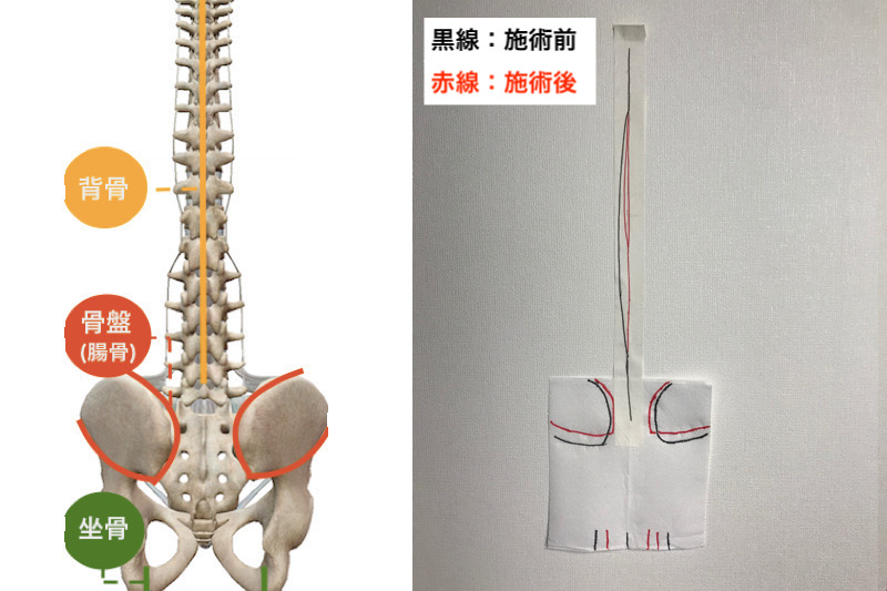 施術体験 こんな風に背骨と骨盤の歪みを確認できます 町田市 多摩境 整体院 楽 慢性腰痛に特化した骨盤矯正